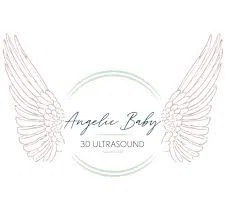 Angelic Baby 3-D Ultrasound Merchant Logo