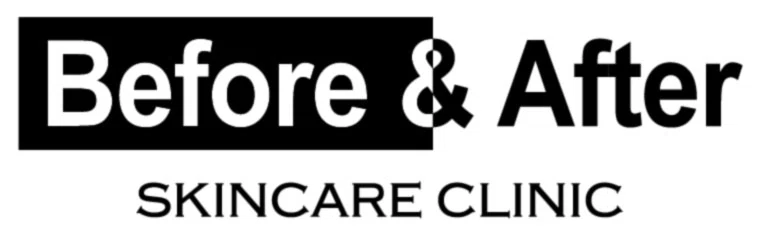 BEFORE AND AFTER SKINCARE CLINIC Promo Code — 139 Off 2024
