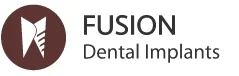 FUSION DENTAL IMPLANTS Promo Code — 200 Off 2024